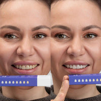 Violet Crush Whitening Strips